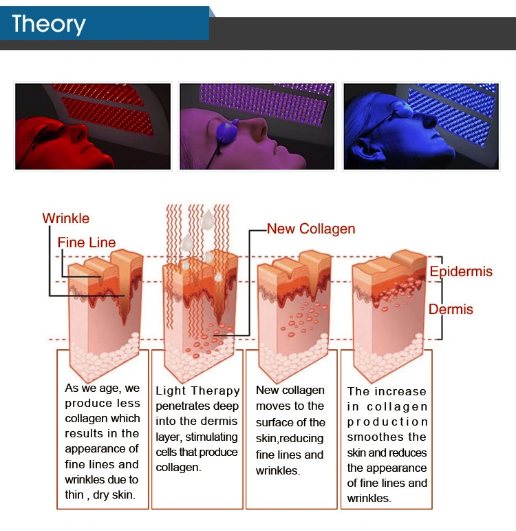 PDT Photodynamics Machine for Beauty Clinic