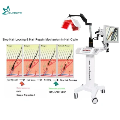 Macchina professionale per la ricrescita dei capelli con laser a diodi per il trattamento della caduta dei capelli